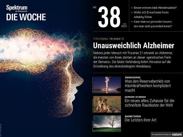 Trisomie 21 – Automatisch Alzheimer