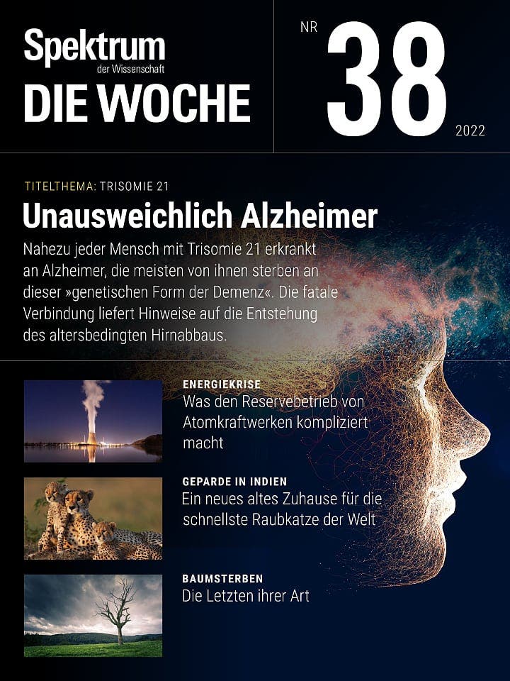 Trisomie 21 – Automatisch Alzheimer