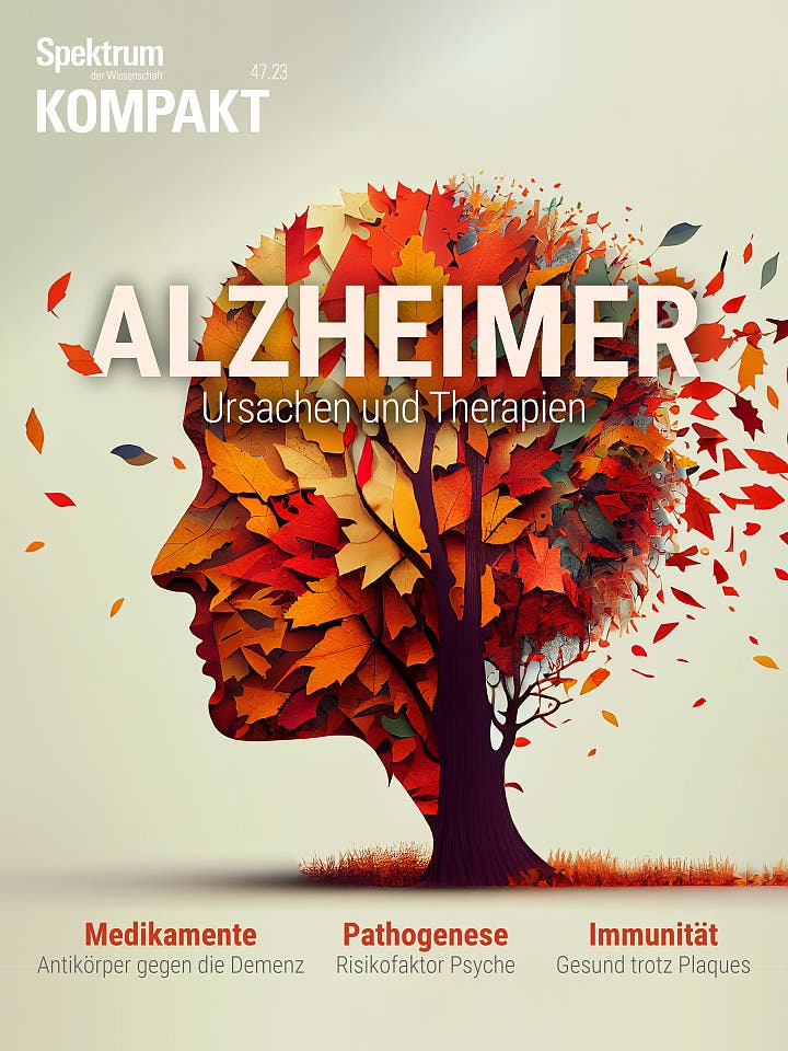Alzheimer – Ursachen und Therapien