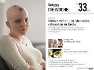 Spektrum - Die Woche - 33/2024 - Warum bekommen so viele junge Menschen Krebs?