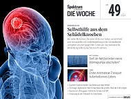 Spektrum - Die Woche - 49/2024 - Selbsthilfe aus dem Schädelknochen