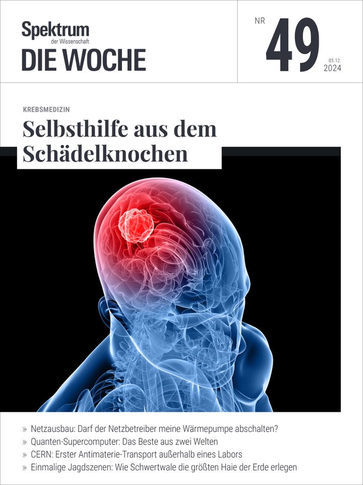 Spektrum - Die Woche - 49/2024 - Selbsthilfe aus dem Schädelknochen