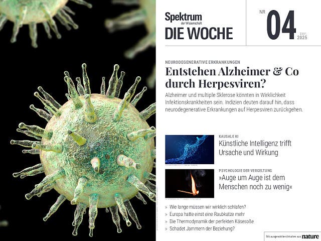  Entstehen Alzheimer & Co durch Herpesviren?