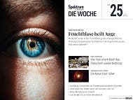 Spektrum - Die Woche - 25/2025 - Fruchtblase heilt Auge Spektrum - Die Woche - 25/2025 - Fruchtblase heilt Auge