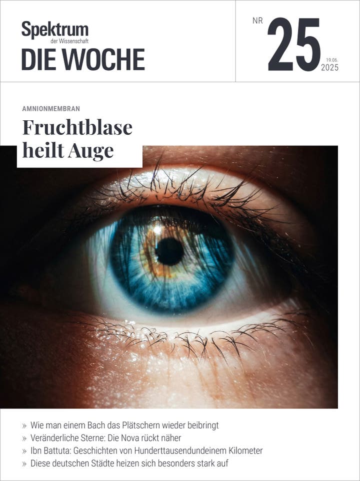 Spektrum - Die Woche - 25/2025 - Fruchtblase heilt Auge