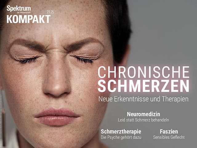 Chronische Schmerzen