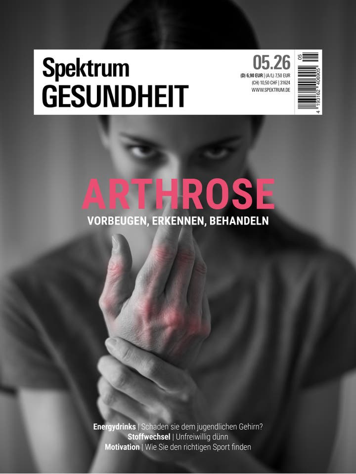 Titelbild des Magazins "Spektrum Gesundheit" mit dem Thema Arthrose. Eine Person h&auml;lt ihre schmerzende Hand, die rot hervorgehoben ist, um Schmerzen zu symbolisieren. Der Text "ARTHROSE: Vorbeugen, Erkennen, Behandeln" steht im Vordergrund. Weitere Themen auf dem Cover sind Energy Drinks, Stoffwechsel und Motivation.