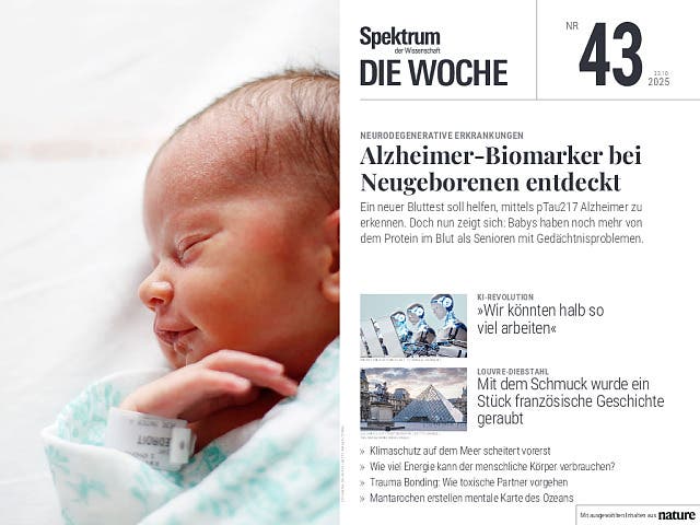 Alzheimer-Biomarker bei Neugeborenen entdeckt