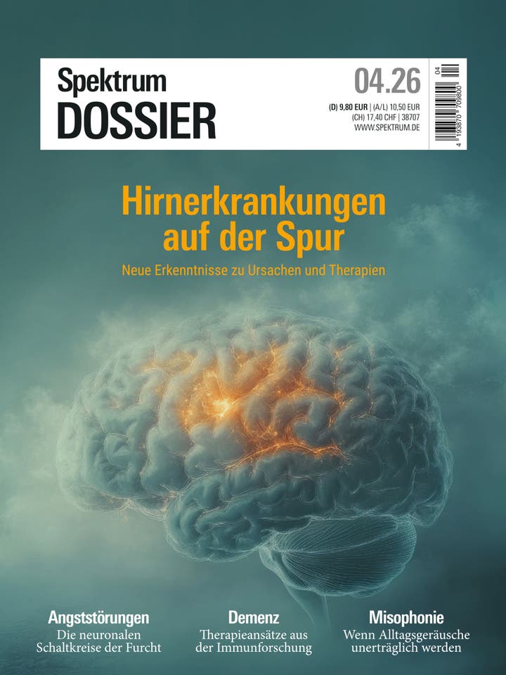 Spektrum Dossier 4/2026 Hirnerkrankungen auf der Spur - Neue Erkenntnisse zu Ursachen und Therapien